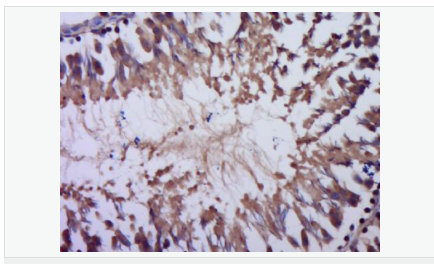 6052b038ccdac.png image.png