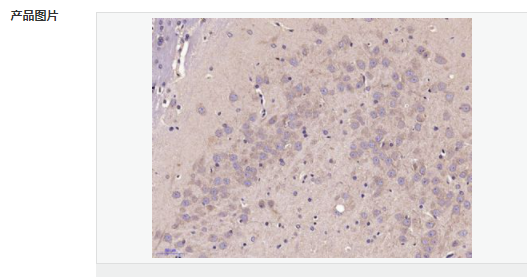 6052bc7f8836b.png image.png