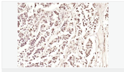 605802c3dfe03.png image.png