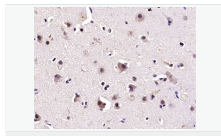 6058445beced9.png image.png