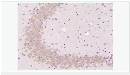 605951c81fb47.png image.png