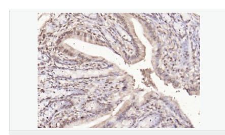 6076489c35b33.png image.png